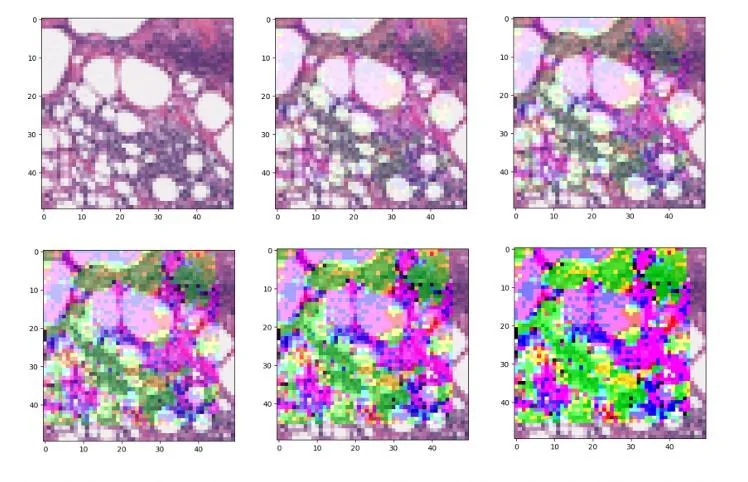 Seis versiones de una imagen histopatológica de cáncer de mama, cada vez más alteradas por un ataque FGSM.